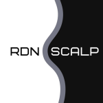 Rdnscalping